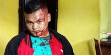 Anak Punk Berulah di Pajak Horas, Keroyok dan Pukul Wartawan Media Oline Pakai Sajam