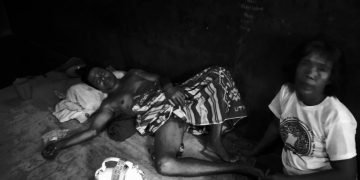 Remas Kemaluan Tetangga Sampai Koyak Hingga Mendapat 20 Jaitan, Pelaku Masih Bebas Berkeliaran