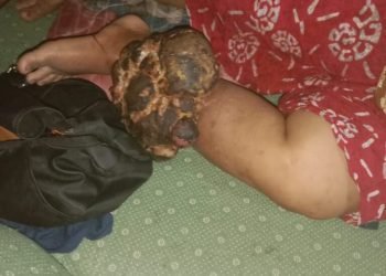 Komando Barisan Rakyat (KOBRA) Kabupaten Batu Bara Fasilitasi Yusniarti Berobat ke Medan