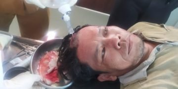 Seorang Pria Ditembak di Warung Kopi, Jatanras Polres Simalungun Selidiki Pelaku