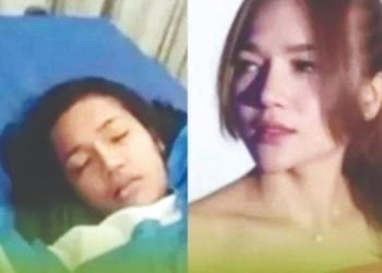 Selebgram asal Medan, Tewas Usai Sedot Lemak