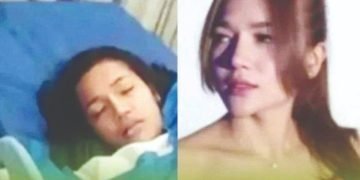 Selebgram asal Medan, Tewas Usai Sedot Lemak