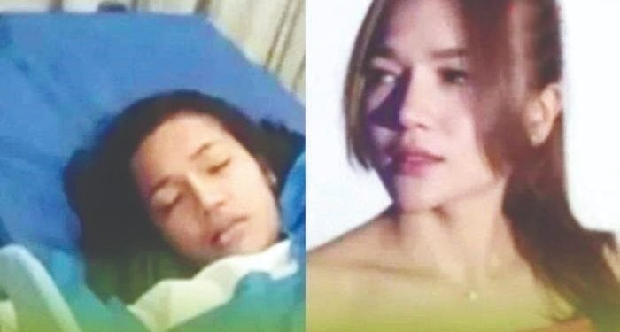 Selebgram asal Medan, Tewas Usai Sedot Lemak