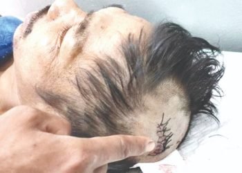 Gara-Gara Buah Durian Kepala Sinaga Pecah Dibalok