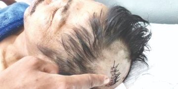 Gara-Gara Buah Durian Kepala Sinaga Pecah Dibalok