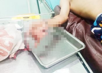 Jalan Arteri Kualanamu Rawan Begal