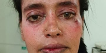 Tolong Saya Pak Kapolres, Aduan Saya sudah 7 bulan Tak Kunjung Diproses