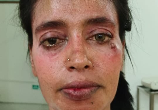 Tolong Saya Pak Kapolres, Aduan Saya sudah 7 bulan Tak Kunjung Diproses