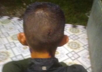 Lp Korban Kasus Penganiayan Dimapolsek Medan Tembung Diduga Lamban Menangkap Pelaku Pengguna Narkoboy