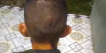 Lp Korban Kasus Penganiayan Dimapolsek Medan Tembung Diduga Lamban Menangkap Pelaku Pengguna Narkoboy