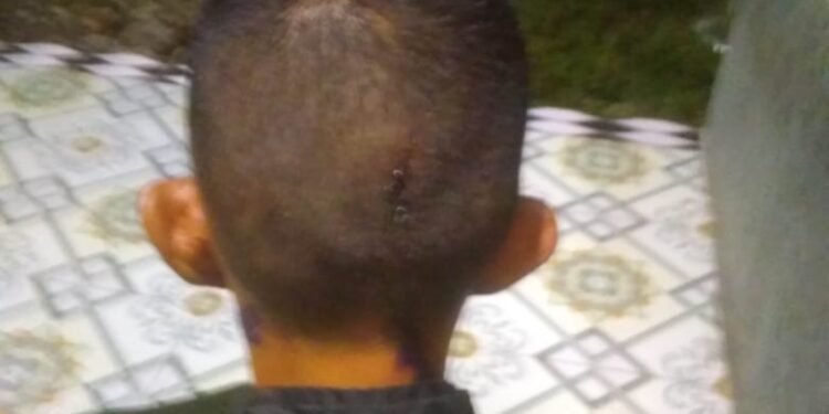 Lp Korban Kasus Penganiayan Dimapolsek Medan Tembung Diduga Lamban Menangkap Pelaku Pengguna Narkoboy