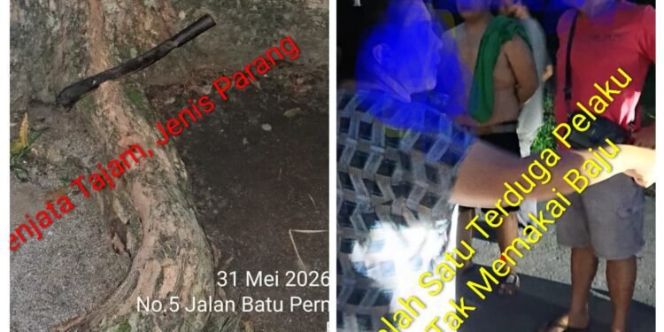 Anak Wartawan Dikeroyok Brutal, Disulut Rokok dan Diancam Parang, Kapolres Pematangsiantar Diminta Jangan Diam!